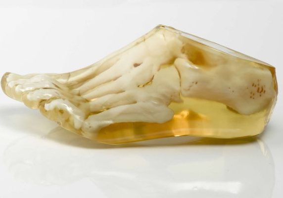 Translucent medical foot model